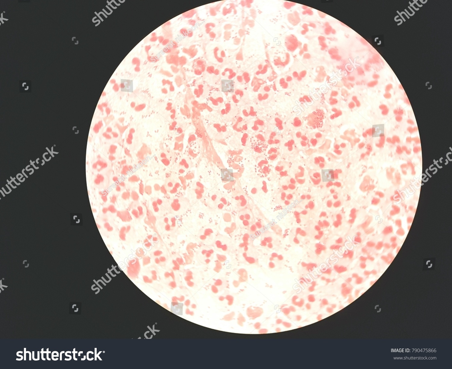 Neisseria Gonorrhoeae Gram Stain Foto Stock Shutterstock