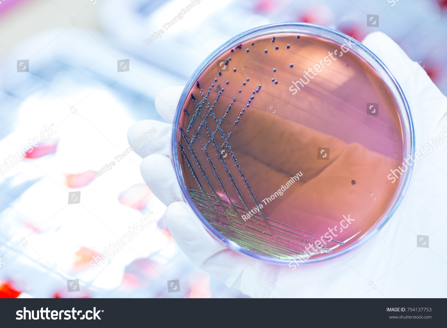 Colony Characteristics Escherichia Coli E Coli Foto Stok 794137753 ...