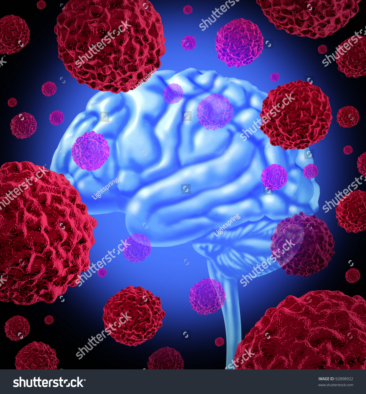 Human Brain Cancer Cells Spreading Growing Stock Illustration