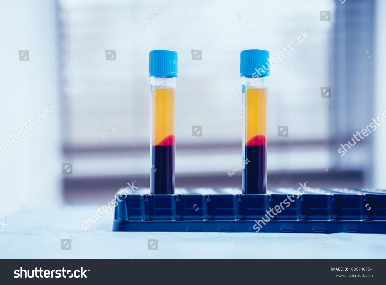 Platelet-Rich plasma preparation. Plasma in syringe. Centrifuge. Background #1006740754