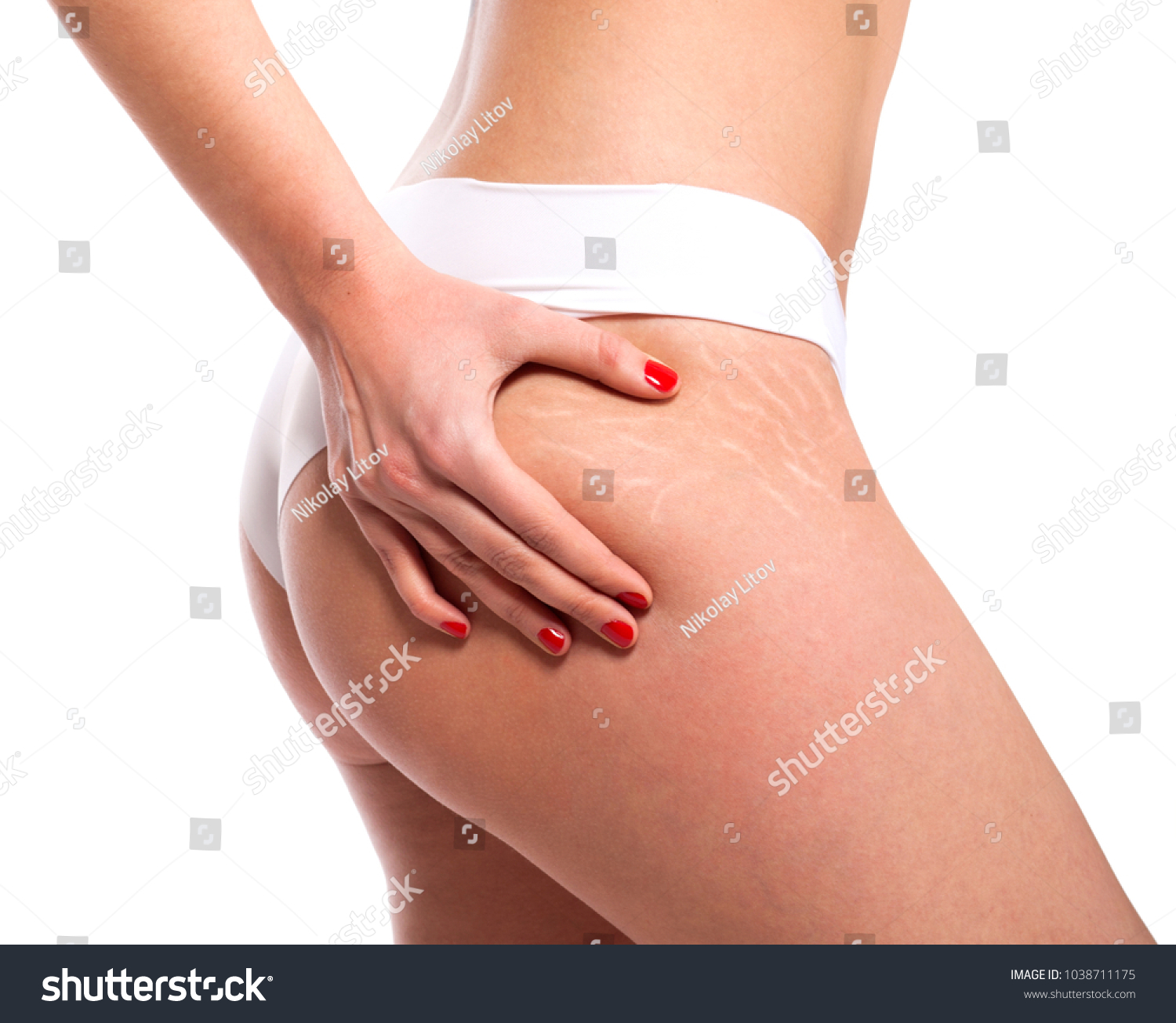 Stretch marks on woman's buttocks. Skin care concept. #1038711175
