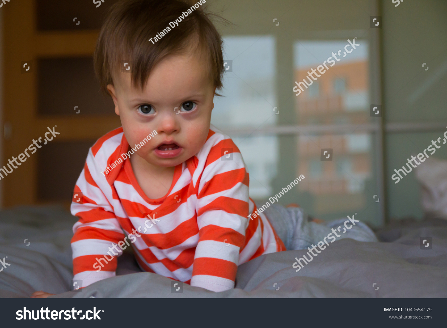 Portrait of cute baby boy with Down syndrome #1040654179
