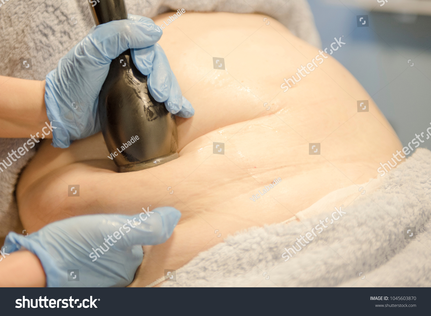 Cavitation hardware cosmetology for getting rid of cellulite #1045603870
