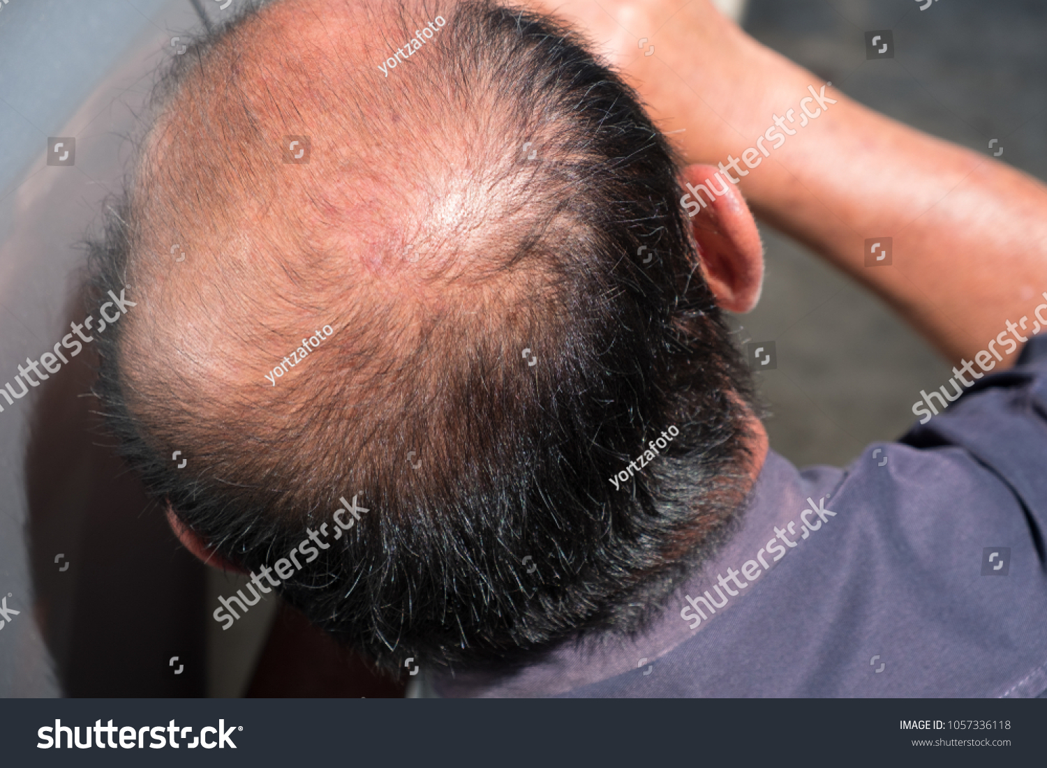 closedup of Behind the head, bald man #1057336118