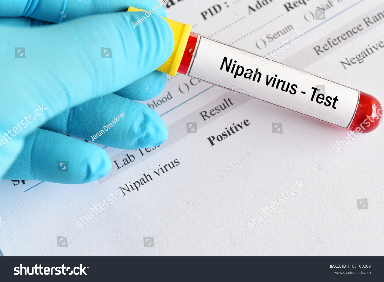 Positive result of Nipah virus test with blood sample tube #1103160209