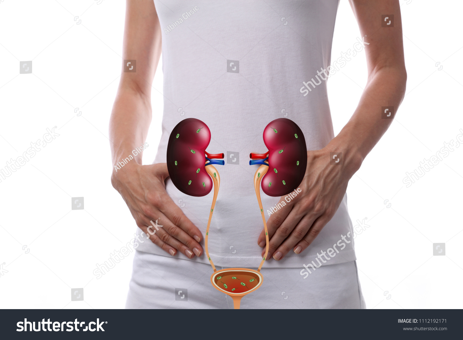 Woman Urinary Tract Infections concept #1112192171
