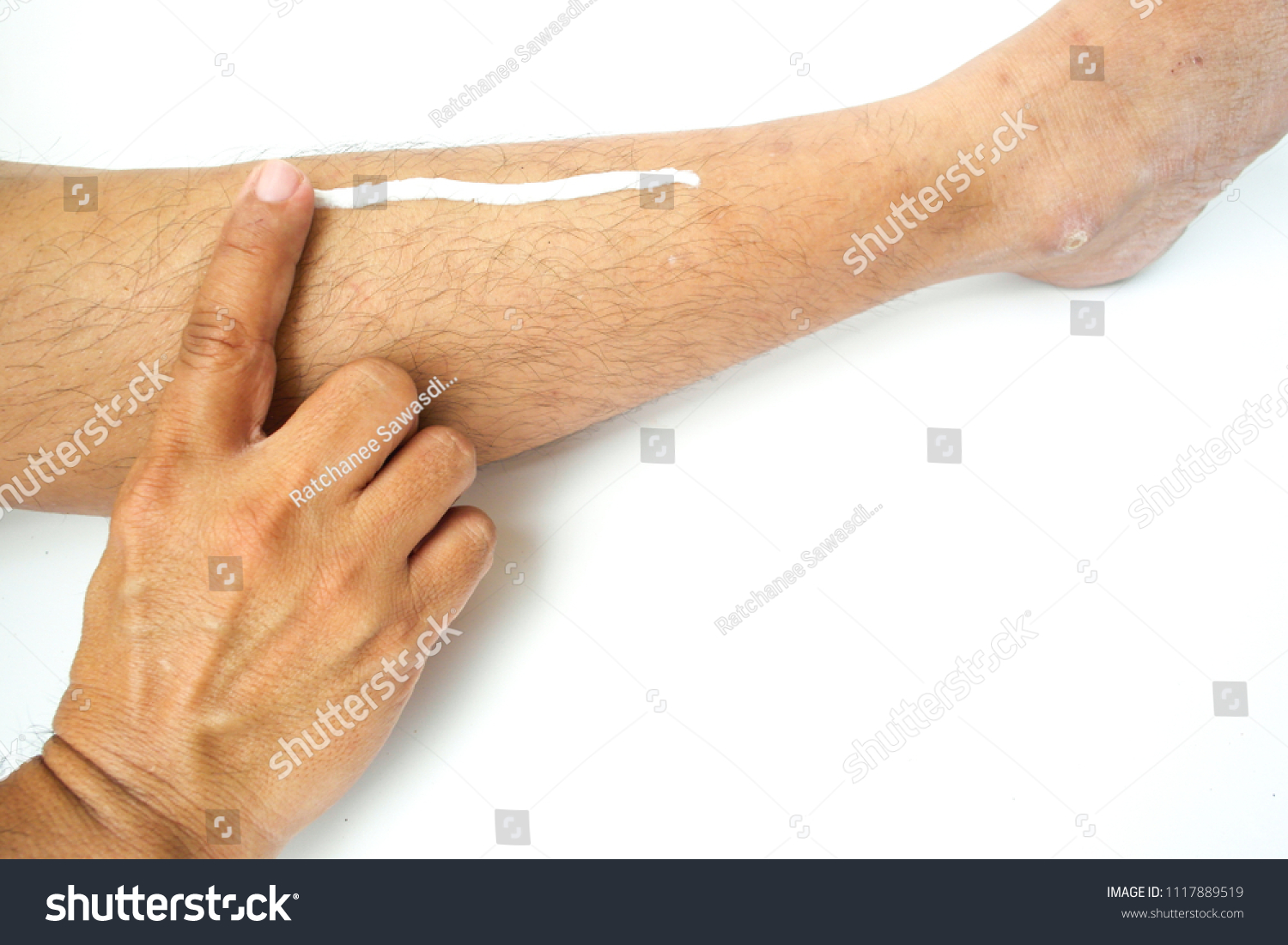 Asian man use his fingers to apply white cream on his leg #1117889519
