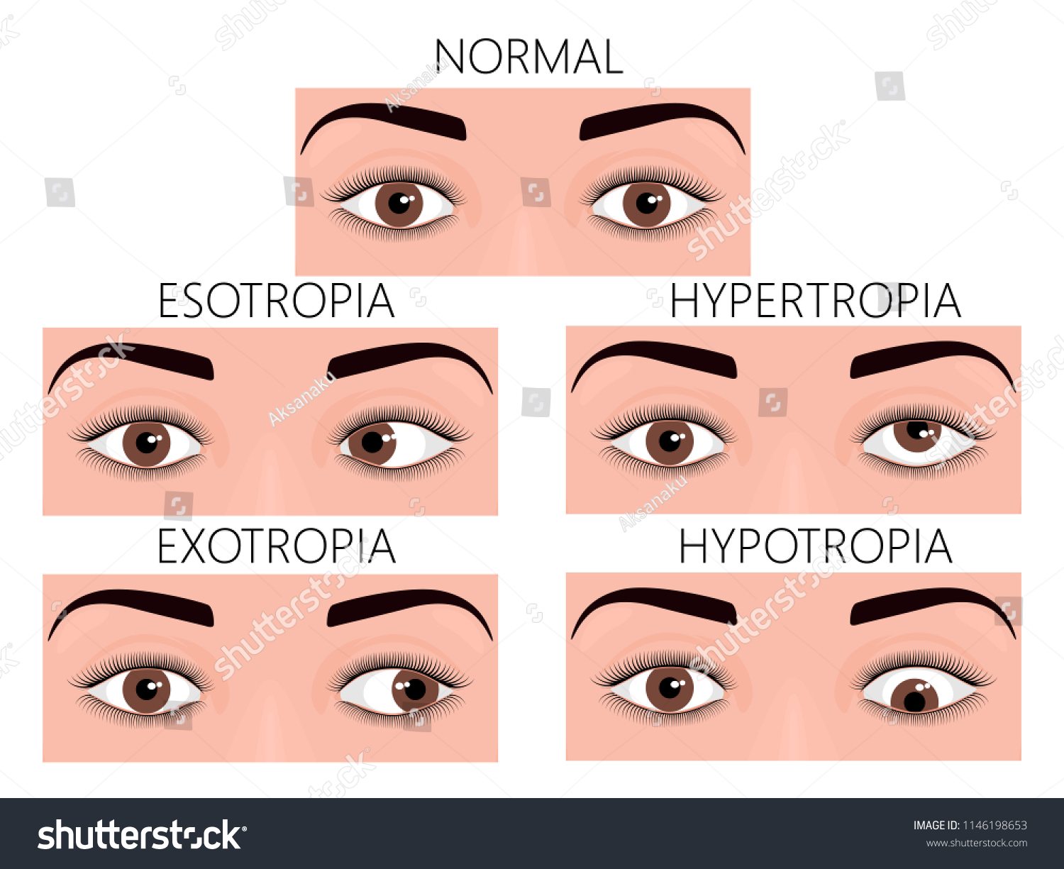 Vector Illustration Of Normal Human Eyes And Royalty Free Stock Vector Avopix Com