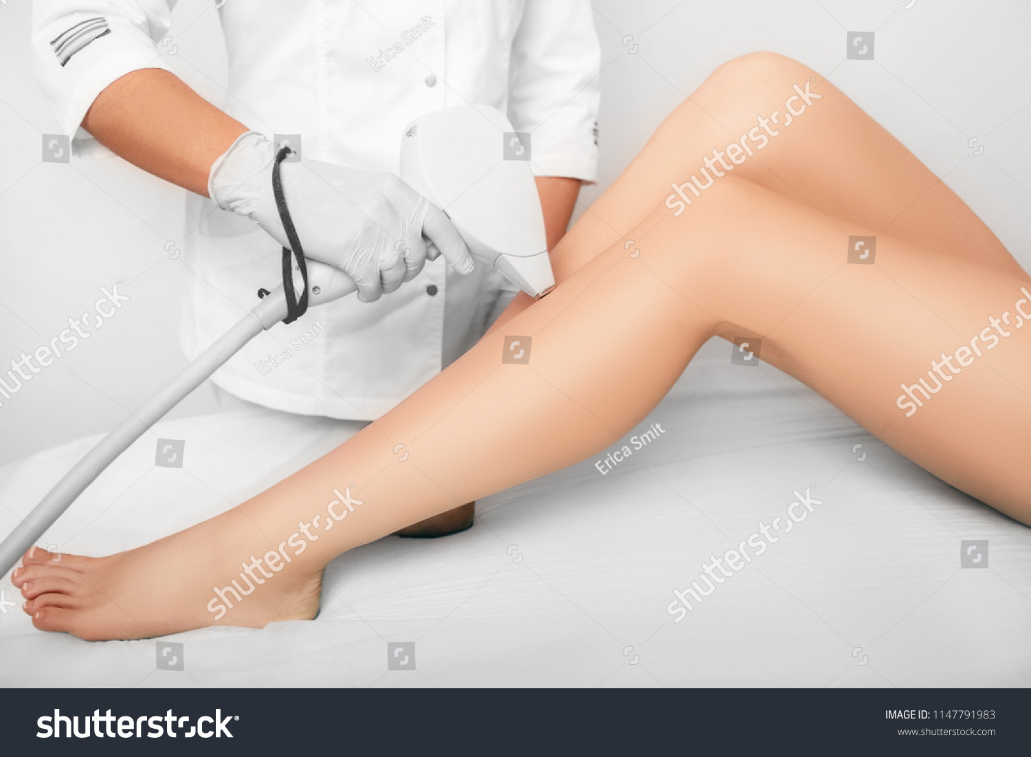 beautician removes hair on beautiful female legs using a laser. hair removal on the legs, laser procedure at clinic #1147791983