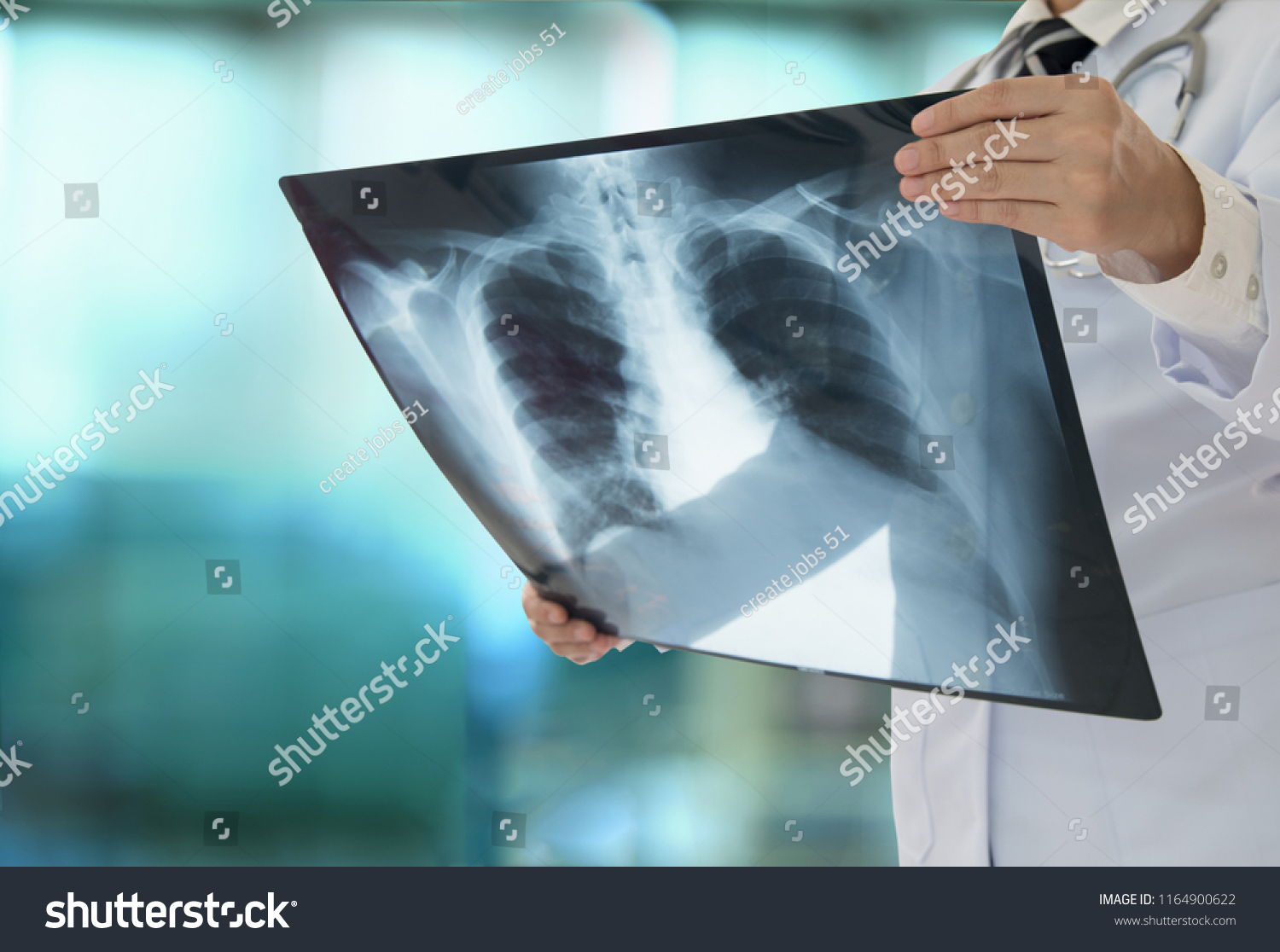 lung radiography concept. radiology doctor examining at chest x ray film of patient at hospital room. #1164900622
