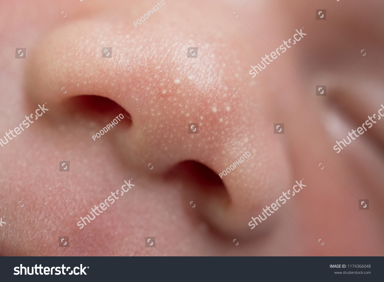 Macro, close-up shot of the milia on a two day old baby cheek
, nose and forehead. #1174366048