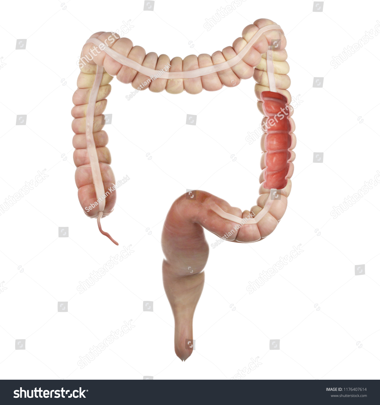3d rendered medically accurate illustration of the interior colon #1176407614