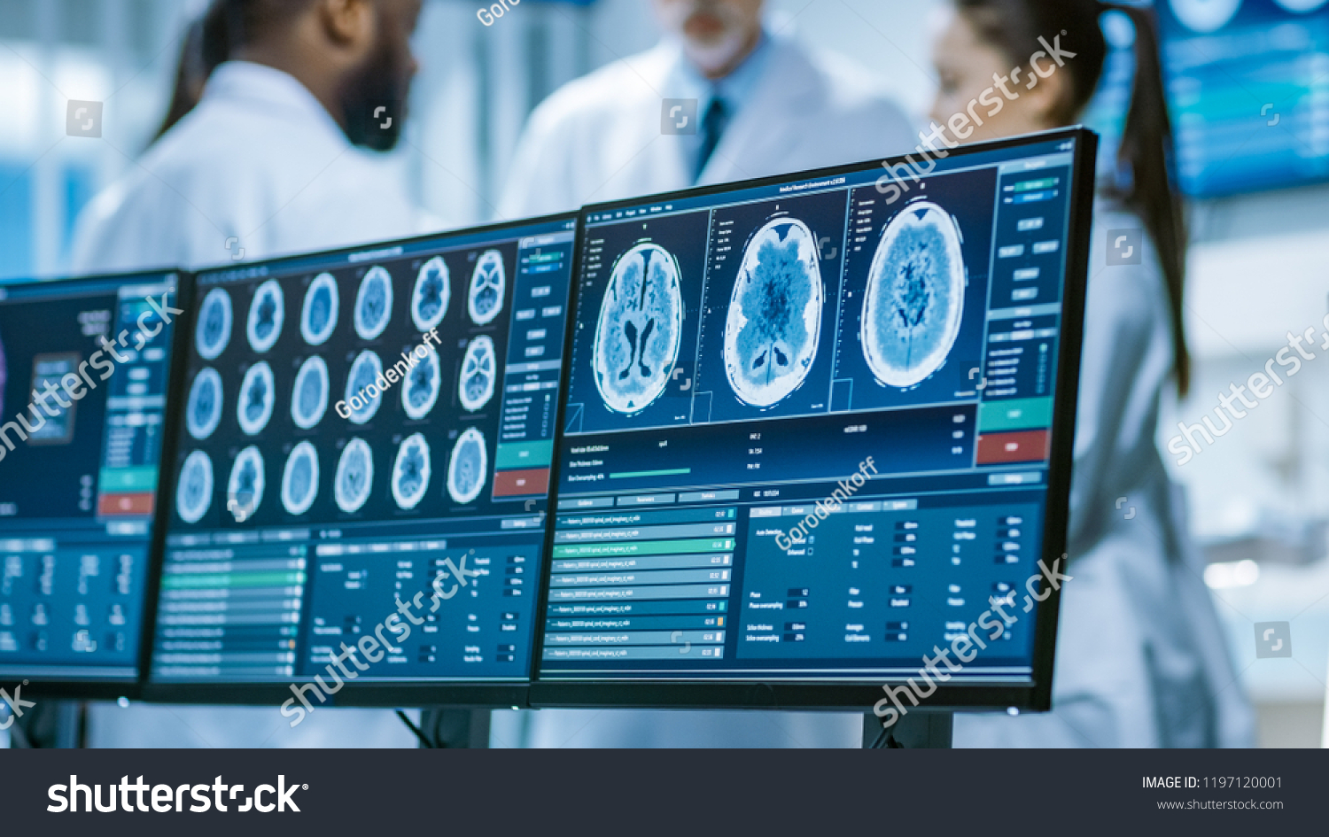 Computer Screen Showing MRI, CT Image Scan of the Brain. In the Background Meeting of the Team of  Medical Scientists in the Brain Research Laboratory. Neurologists / Neuroscientists Having Discussion #1197120001