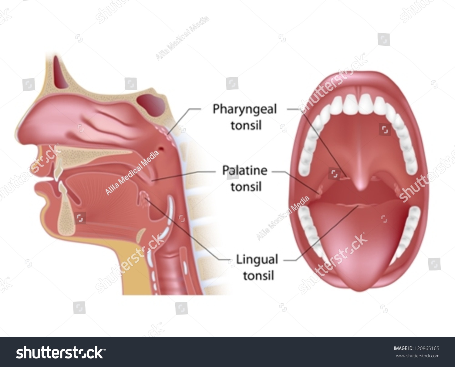 Tonsils in open mouth view and sagittal view - Royalty Free Stock ...