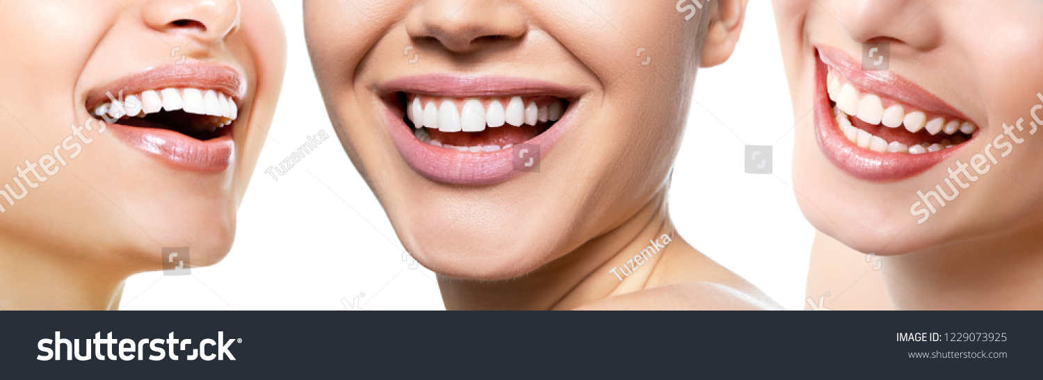 Beautiful wide smile of young fresh women with great healthy white teeth, isolated over white background. Smiling happy women. Laughing female mouth. Teeth health, whitening, prosthetics and care #1229073925