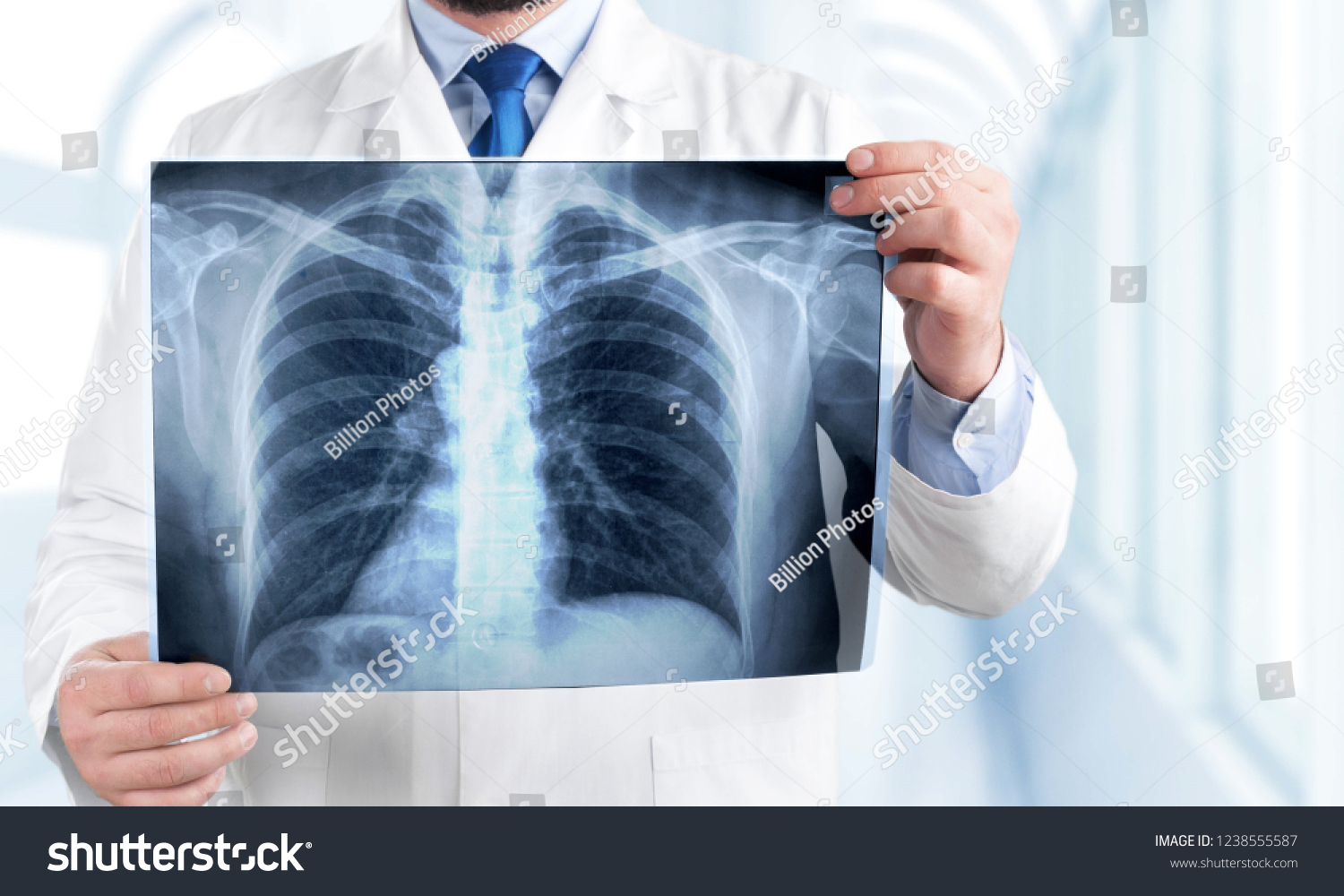 Young man doctor holding x-ray #1238555587