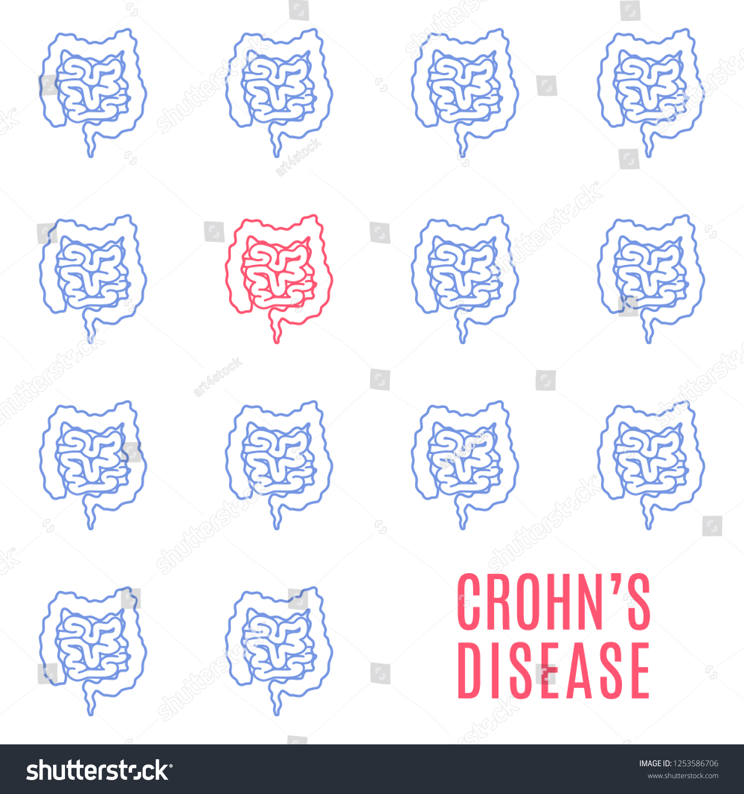 Crohns disease awareness poster. Medical pattern - Royalty Free Stock ...