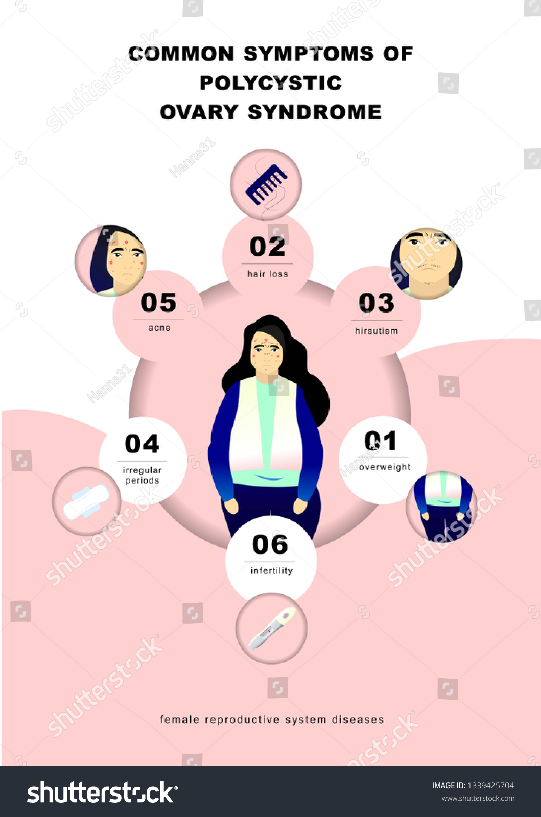 Pcos Symptoms Infographic Royalty Free Stock Vector 1339425704