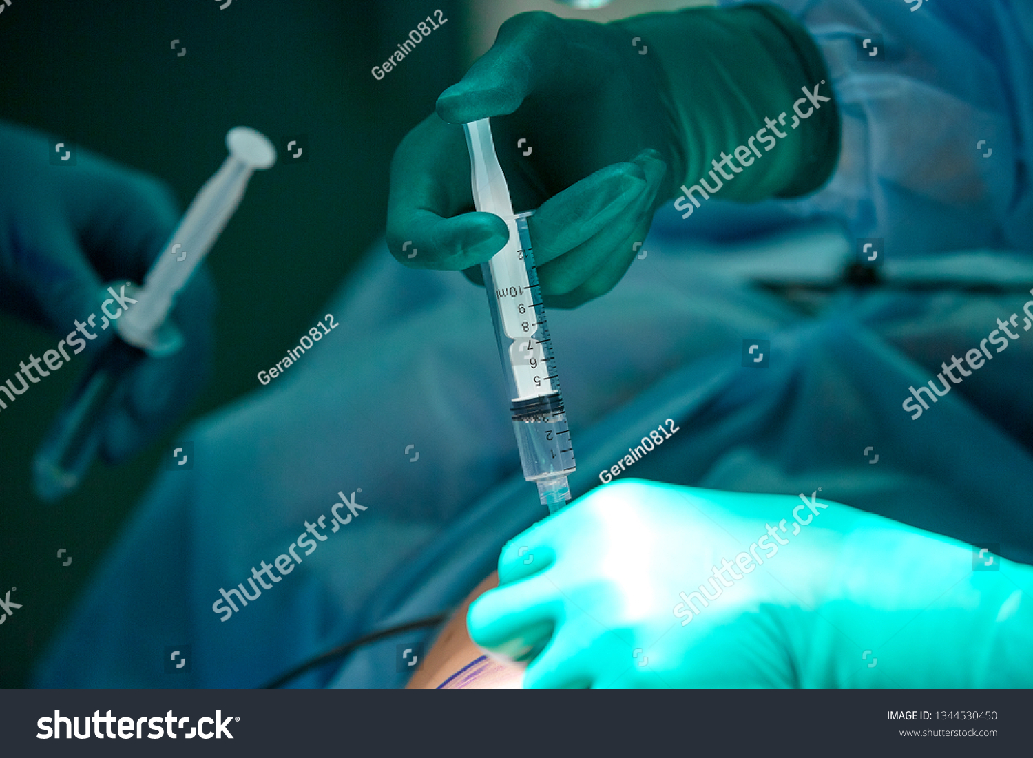 Close up picture of doctor 's hand while inject the anesthetic agent under the patient 's skin. Local anesthesia was use before perform surgery #1344530450