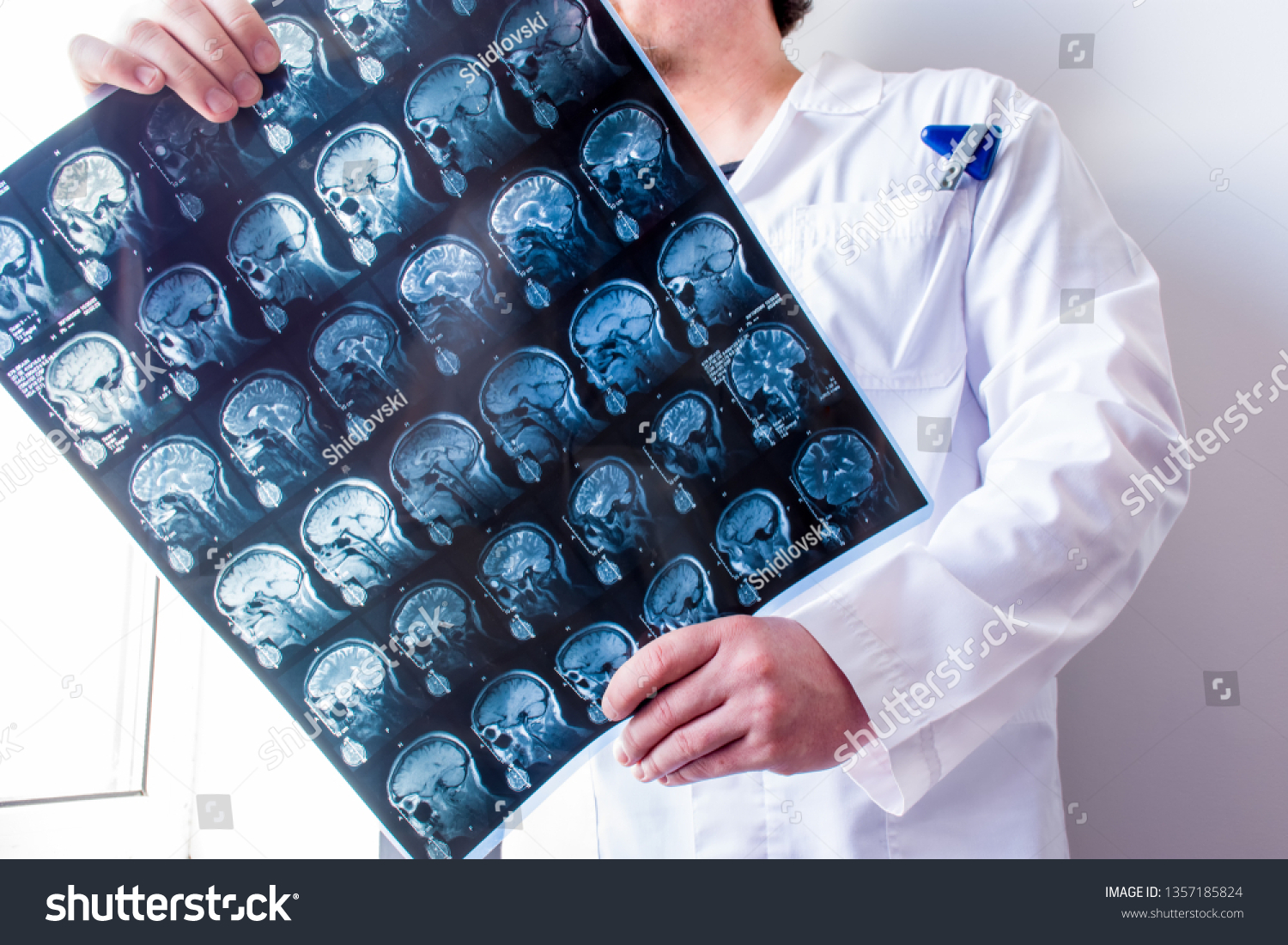 Neurologist or neurosurgeon upright holding MRI brain scanning viewing and exploring it for pathologies of central nervous system. Photo concept of MRI and CT diagnostics in neurology and neurosurgery #1357185824
