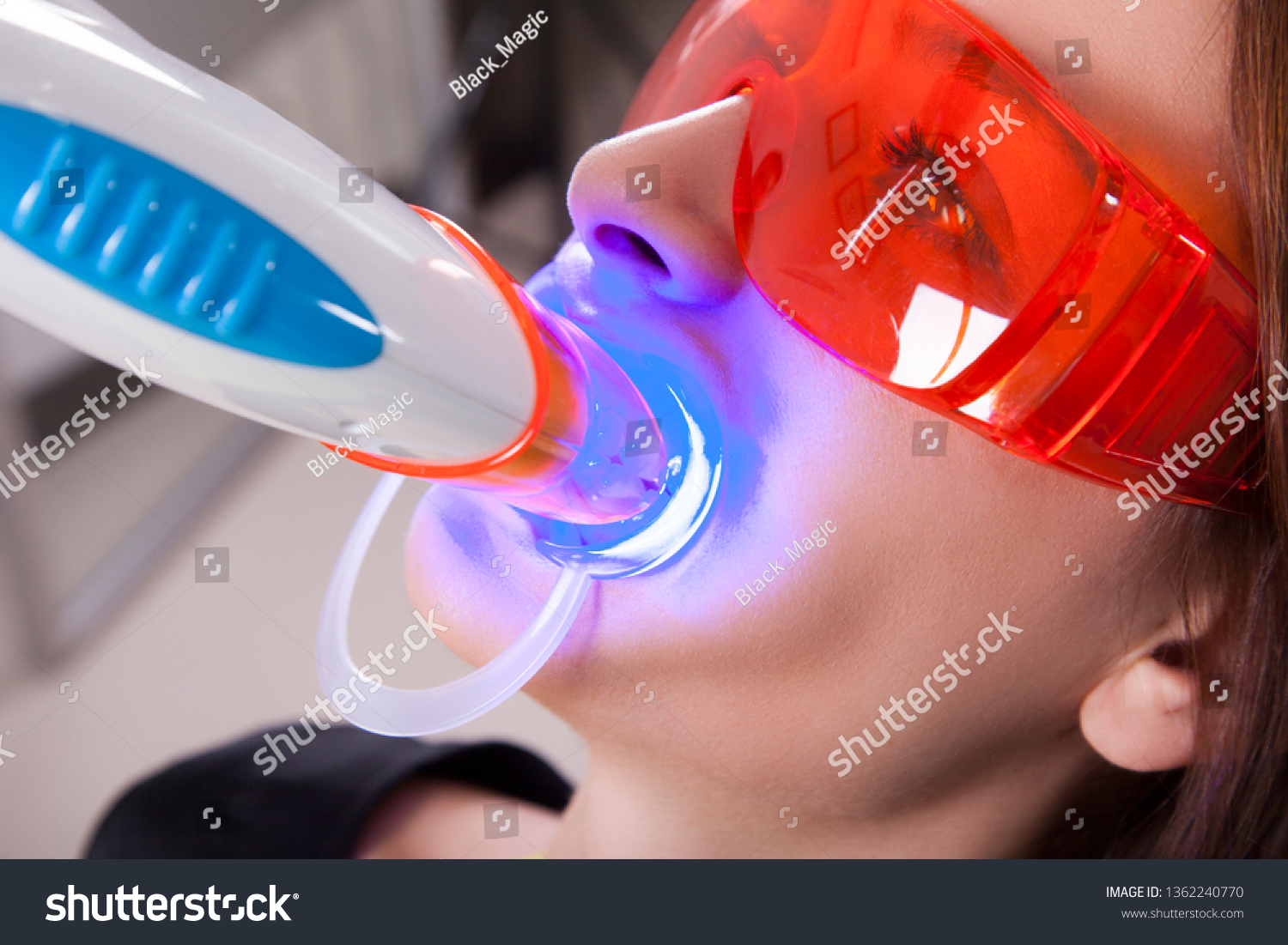 Teeth whitening process with ultraviolet UV light. #1362240770