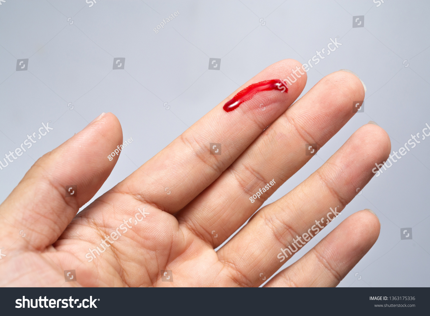 Bleeding blood from the cut finger wound. - Royalty Free Stock Photo ...