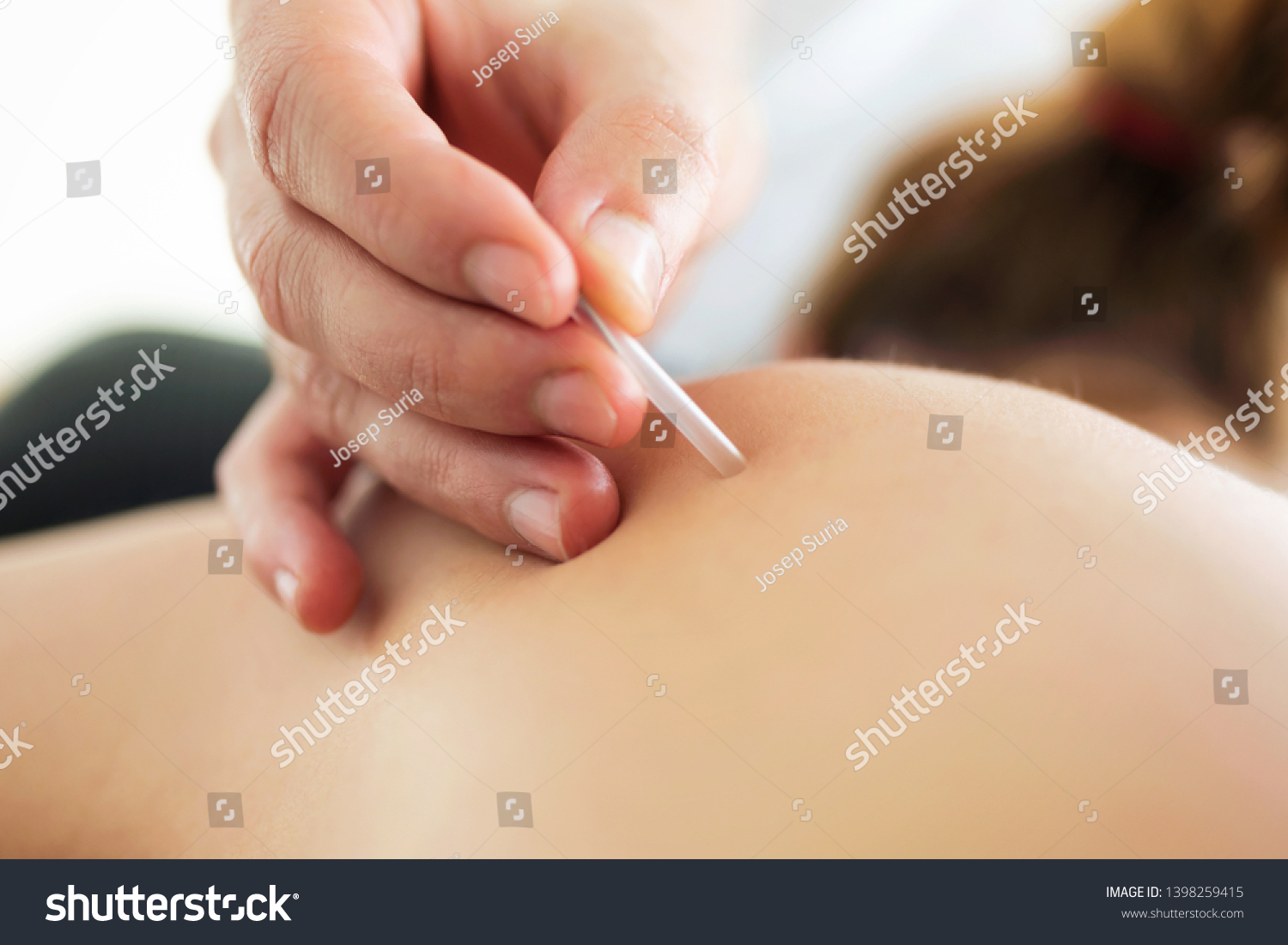 Close-up of young physiotherapist doing a trigger point injection in patient back. #1398259415