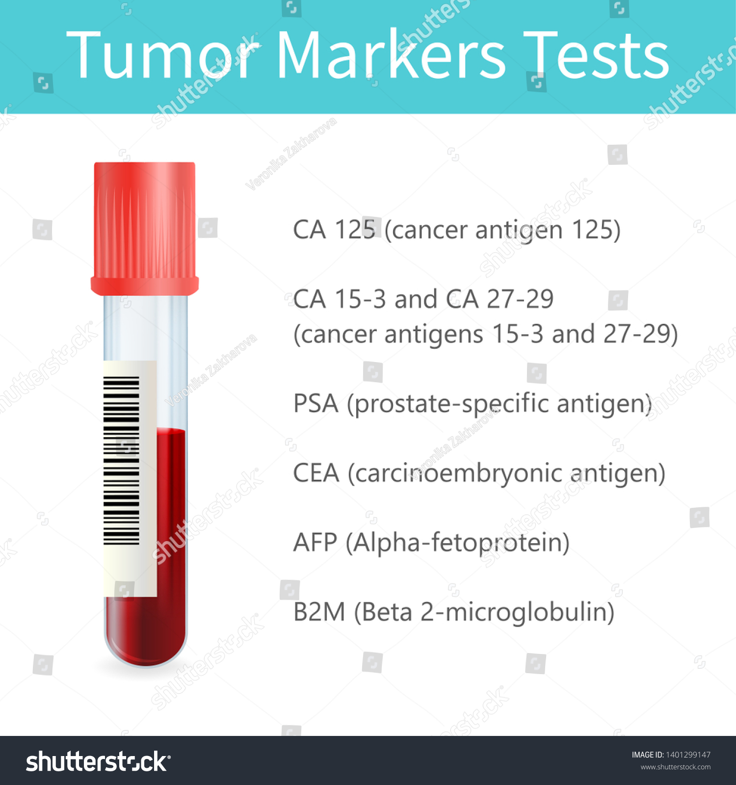 Blood cancer tumor marker test. medical - Royalty Free Stock Photo ...