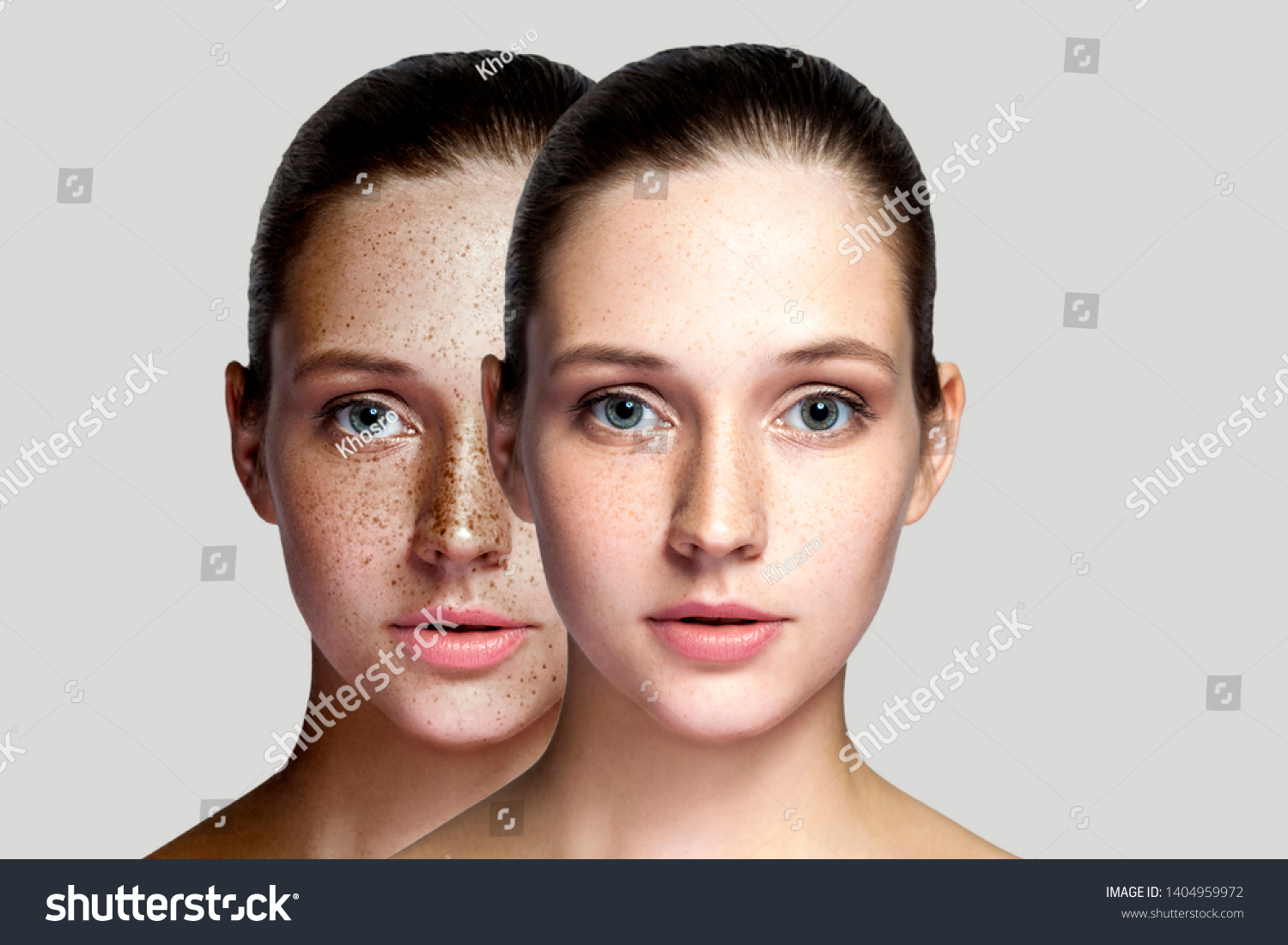 Closeup before and after portrait of beautiful brunette woman after laser treatment removing freckles on face looking at camera. makeup or cosmetology. indoor studio shot, isolated on gray background. #1404959972