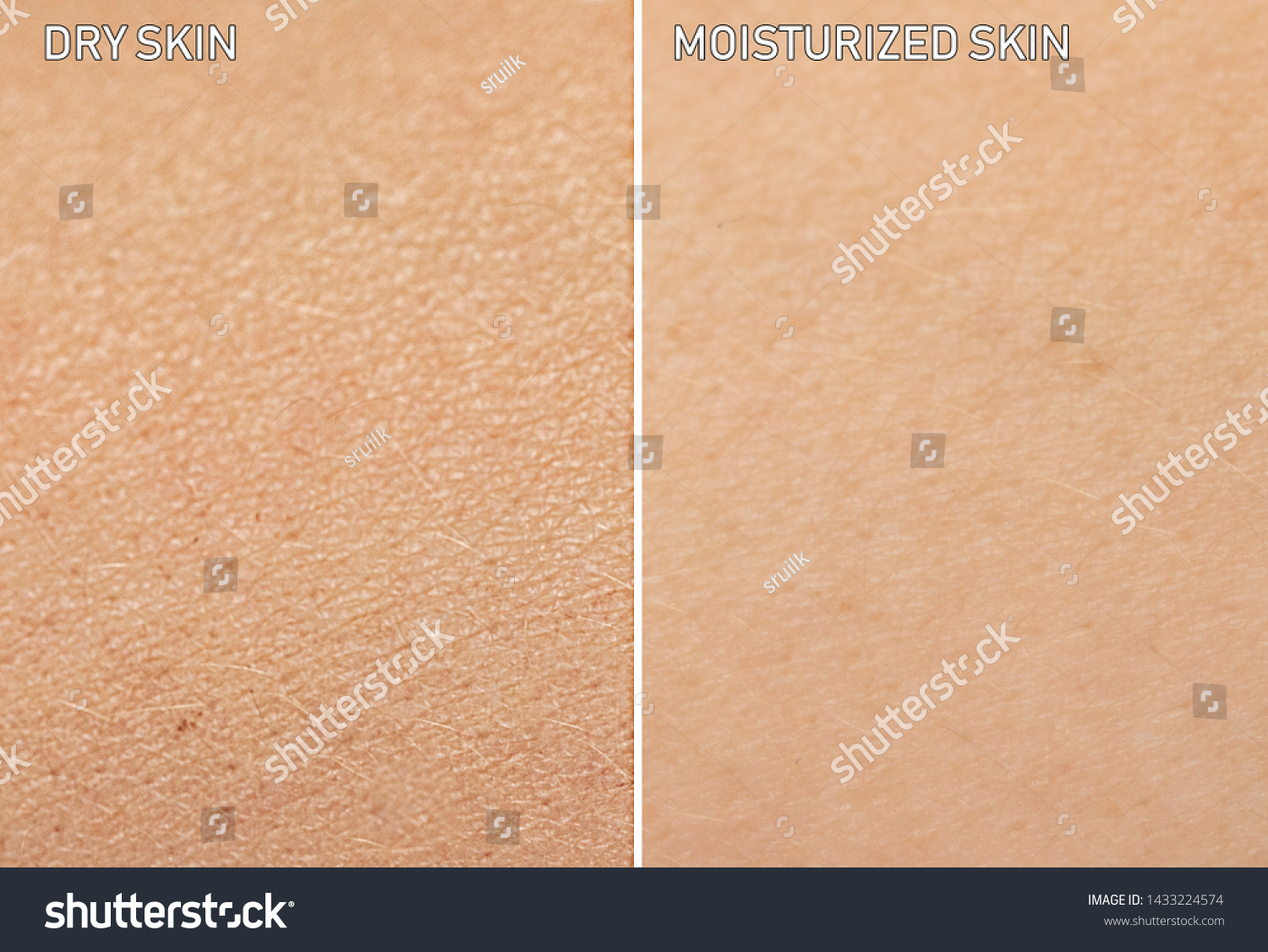 An extreme close up view of human skin, before and after moisturizer is applied. One showing dry skin, and the other showing healthy moisturized skin. #1433224574