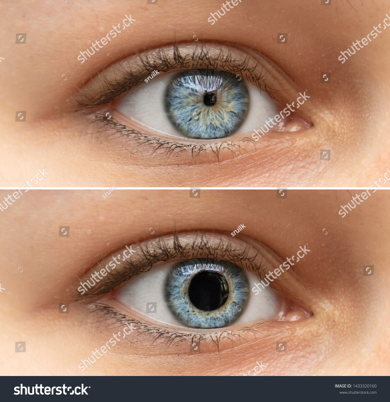 A closeup view on the blue eyes of a pretty young woman. Collage comparing the black pupil, one image shows an enlarged pupil and one shows a reduced pupil. Pupillary light reflex in humans. #1433320160