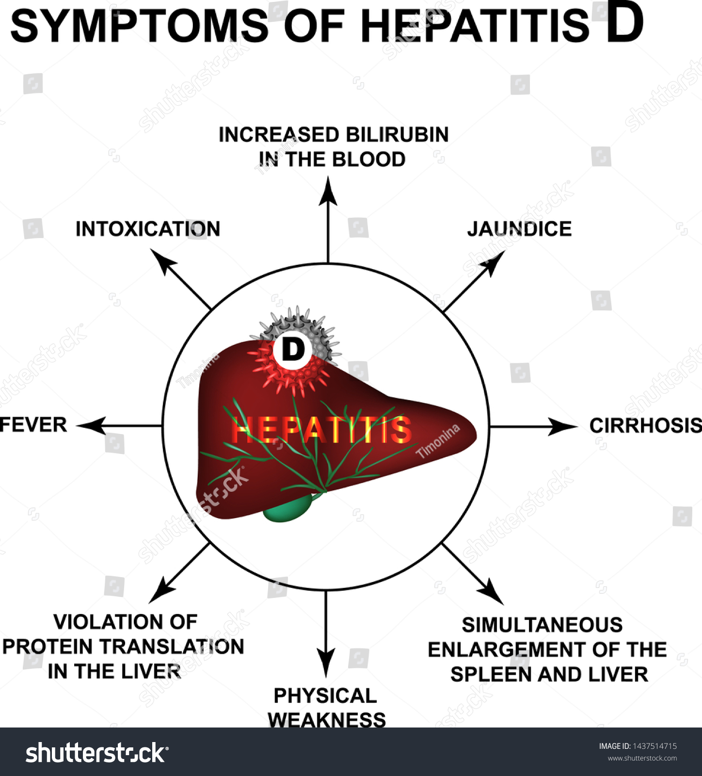 Symptoms Of Hepatitis D. World Hepatitis Day. - Royalty Free Stock ...