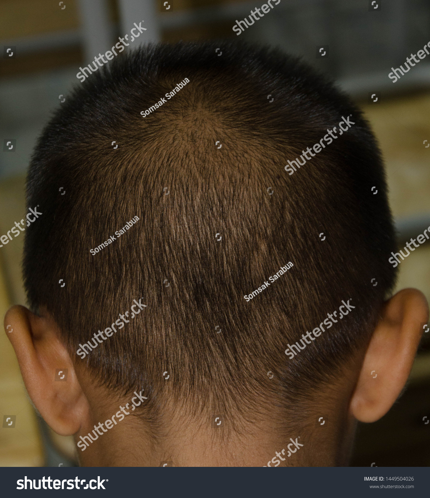 Short hair on the child head, the hair that is circulated is a spiral. #1449504026