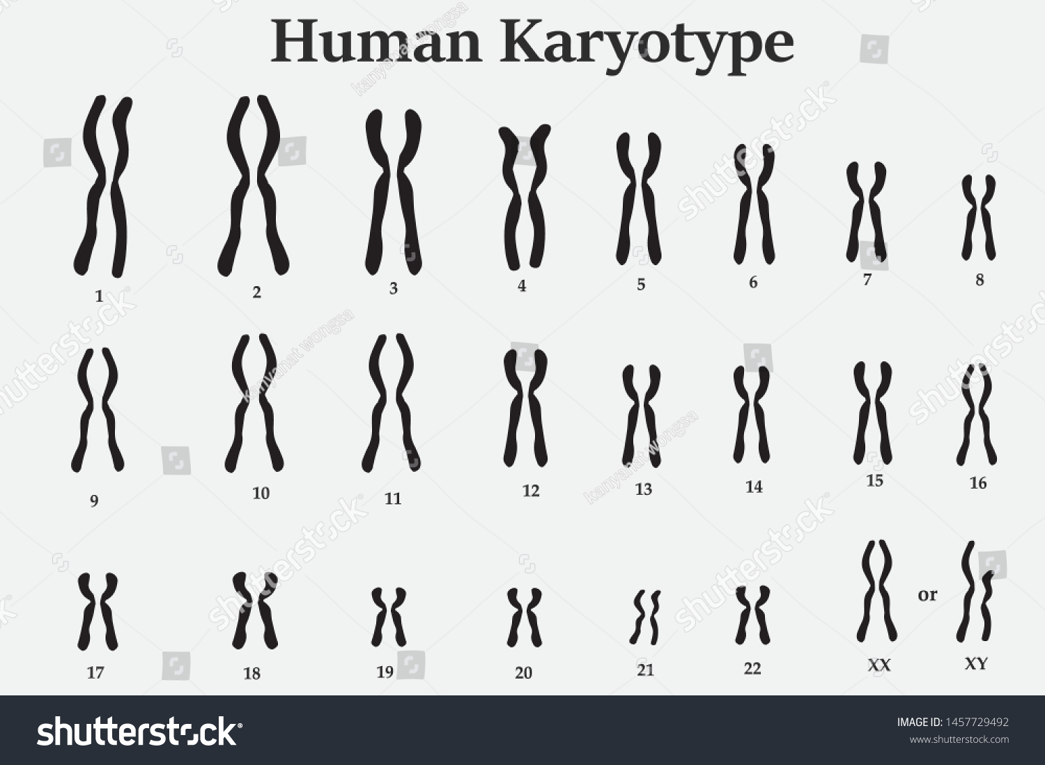 Karyotype Of Normal Human Chromosome Royalty Free Stock Vector 1457729492 7951