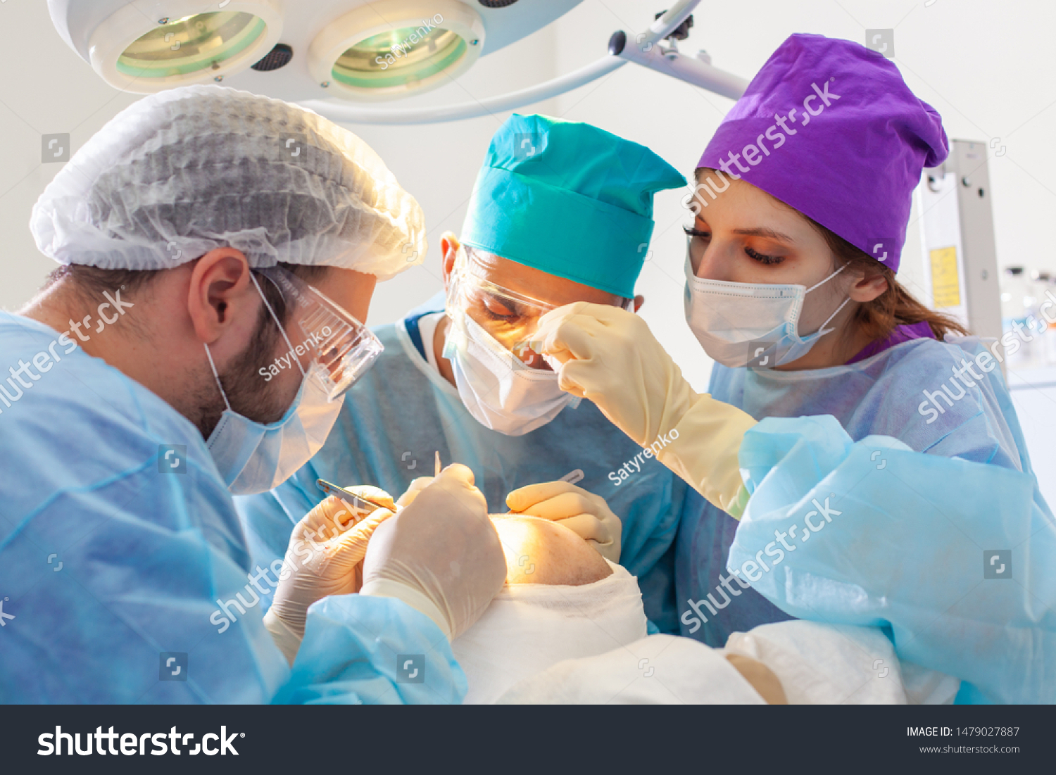 Baldness treatment. Hair transplant. Surgeons in the operating room carry out hair transplant surgery. Surgical technique that moves hair follicles from a part of the head. #1479027887
