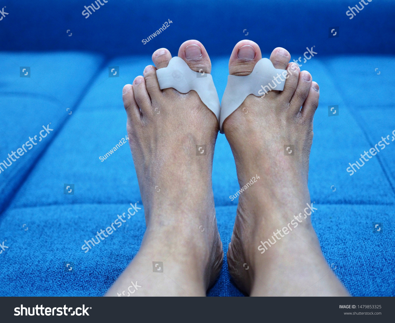 Bare foots which have Hallux Valgus (bunion) problem on blue sofa bed. A deformity of the joint connecting the big toe to the foot and caused painful. #1479853325