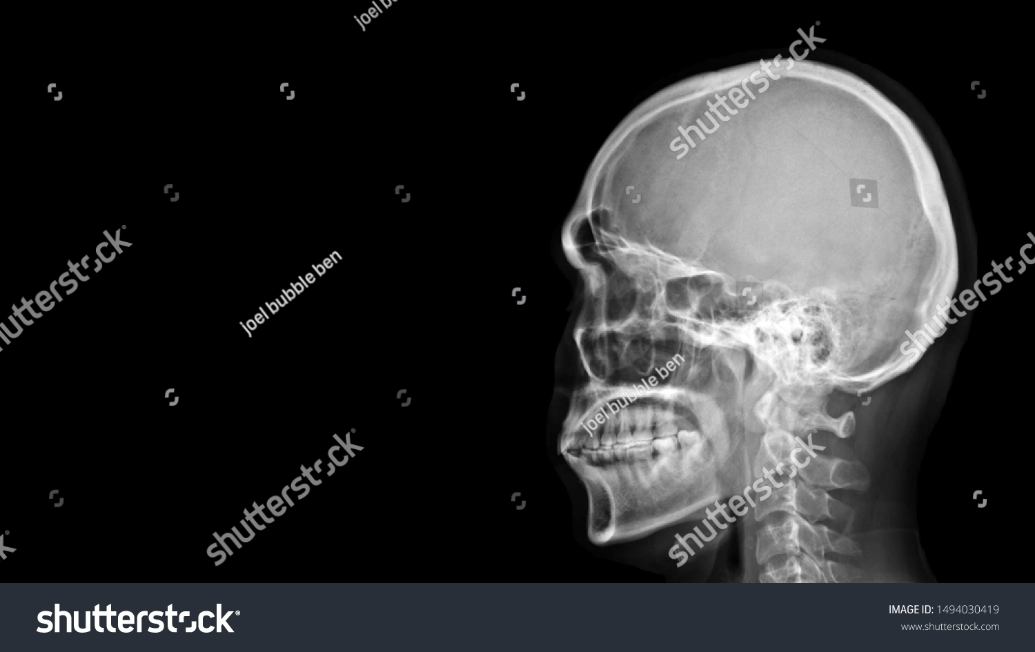 Film X-ray radiograph show human anatomy of bone skull, cervical spine and skeleton with free black space background.  Medical imaging in neurology and radiology concept  #1494030419