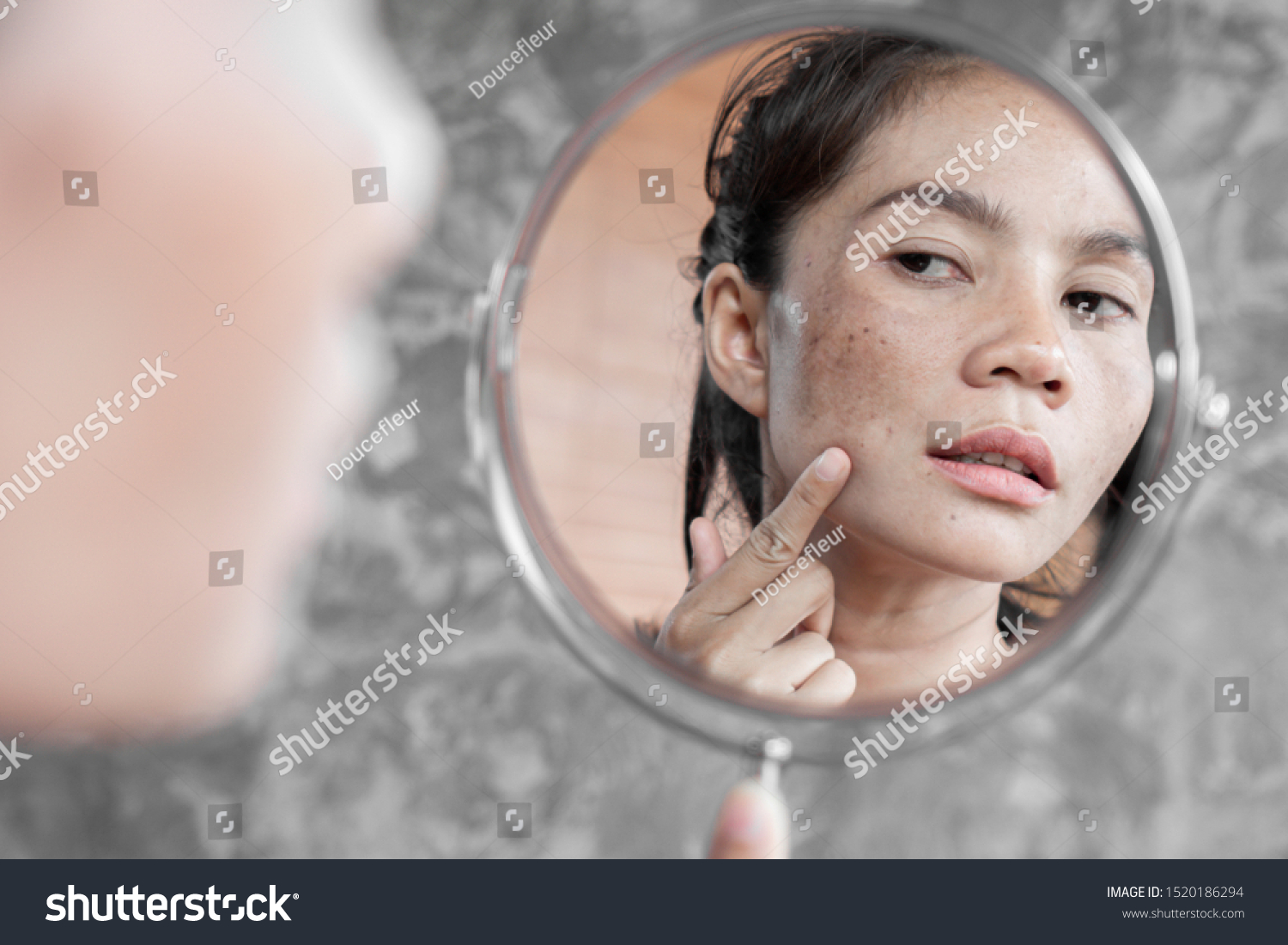 Asian woman having skin problem checking her face with dark spot, freckle from uv light in mirror #1520186294