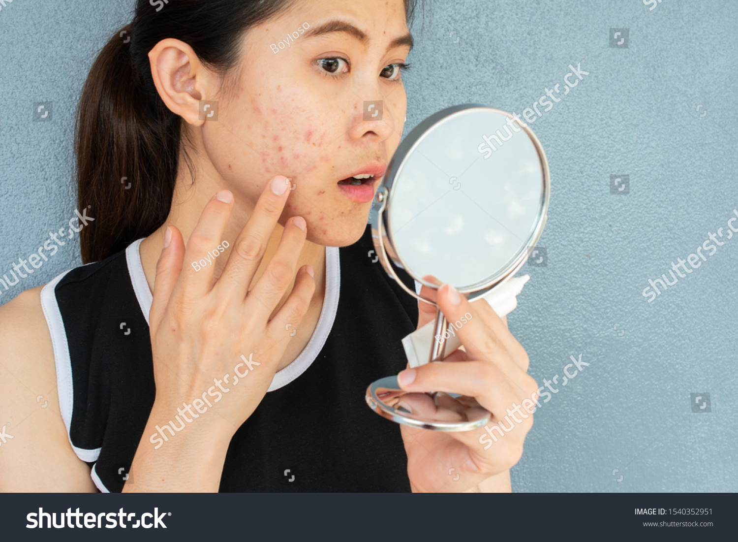 Portrait of Asian woman worry about her face when she saw the problem of acne inflammation and scar by the mini mirror. Conceptual shot of Acne & Problem Skin on female face. #1540352951