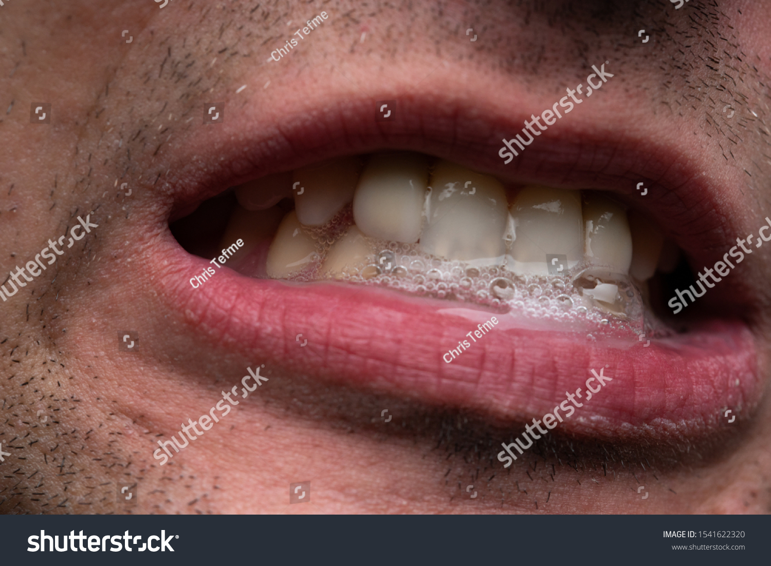 Image of young man with saliva, showing teeth #1541622320