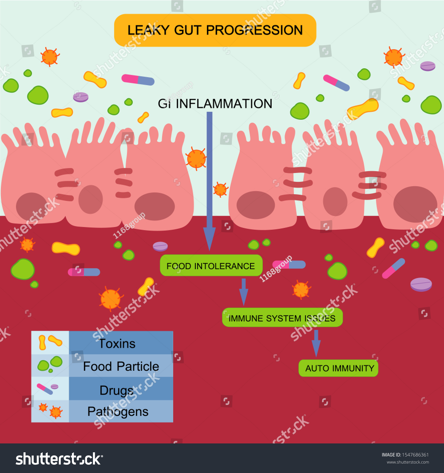 Leaky Gut Syndrome Or Intestinal Permeability Royalty Free Stock