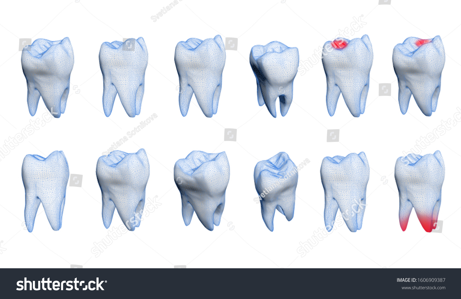 Human healthy and bad tooth 
on a white background. 3d model. #1606909387