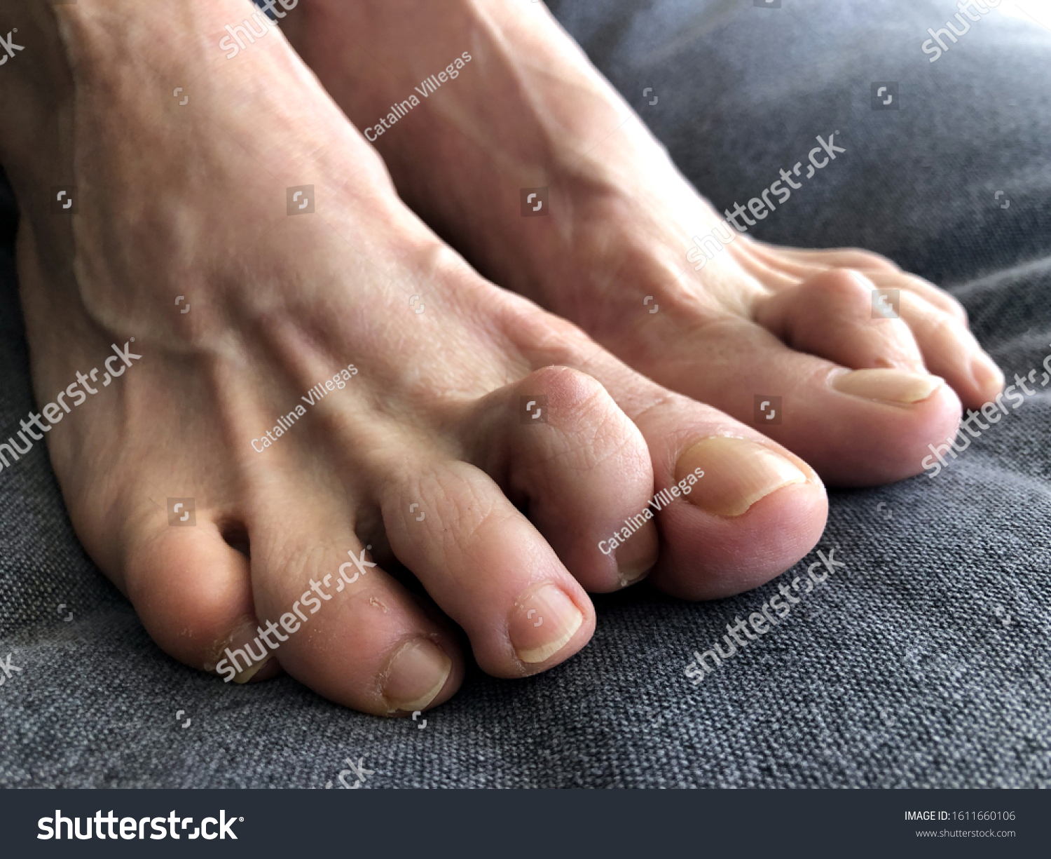 Woman's foot with hammer toe.  #1611660106