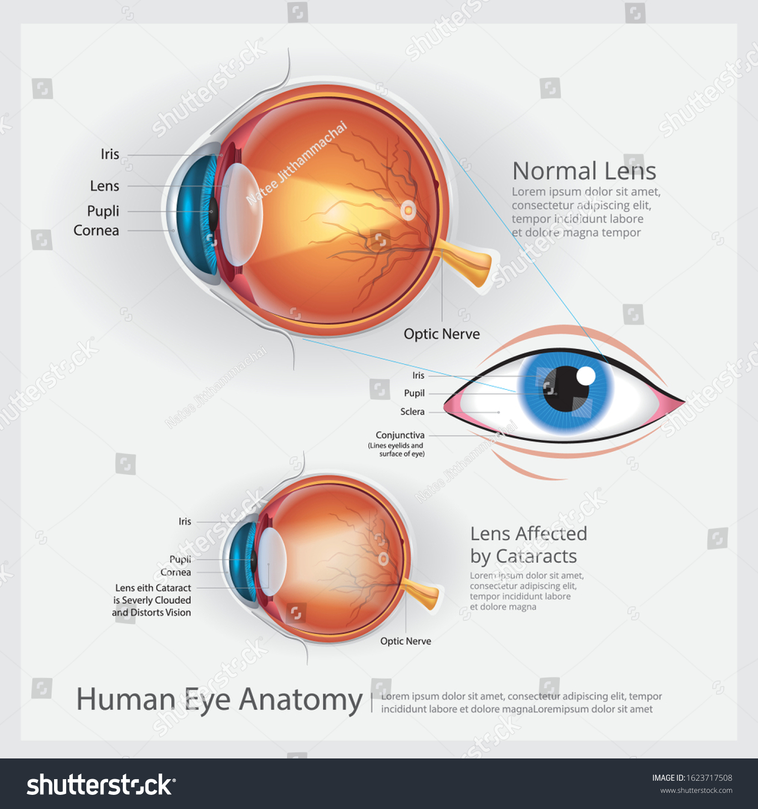 Human Eye Anatomy Vector Illustration - Royalty Free Stock Vector ...