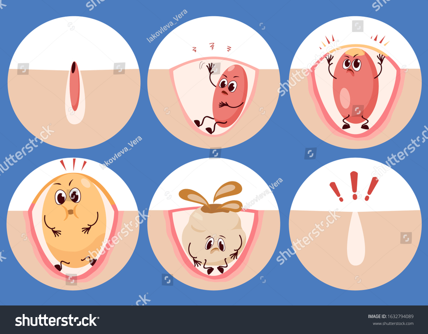 Different Stages And Emotions Of Acne Cute Royalty Free Stock