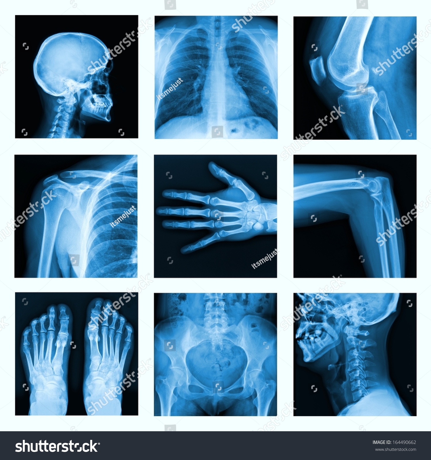 Collage of many X-rays. Very good quality / Many others X-ray images in my portfolio.  #164490662
