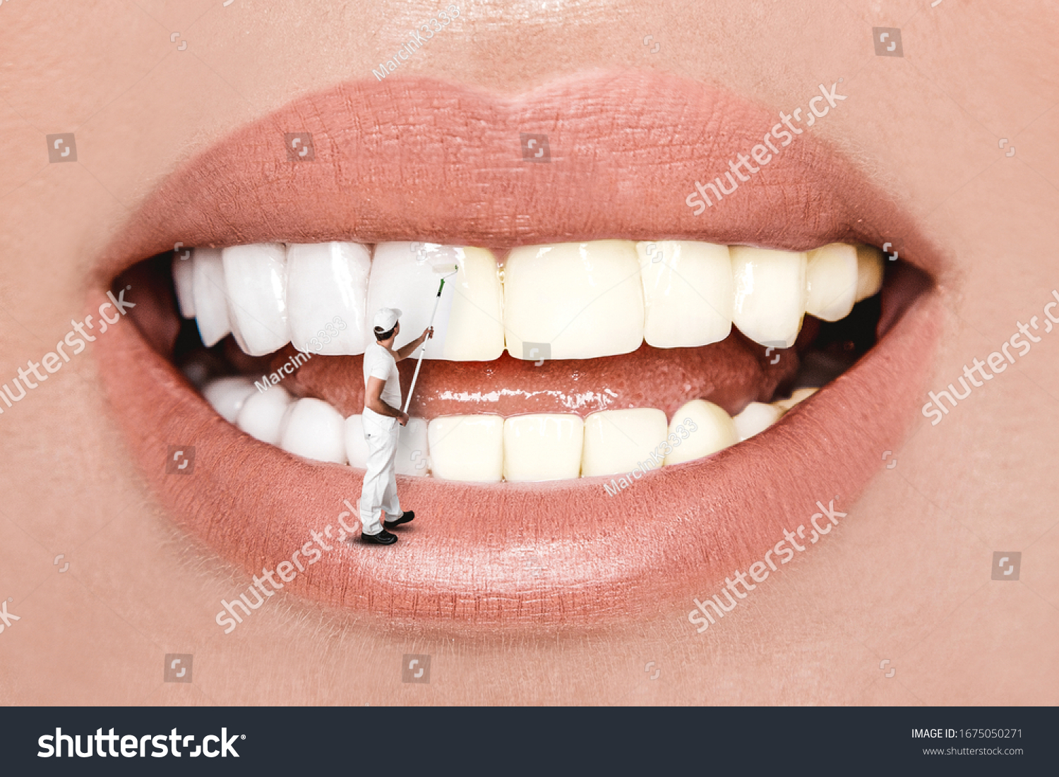 Laughing woman mouth with great teeth over white background. Whitening concept. Dentistry. #1675050271