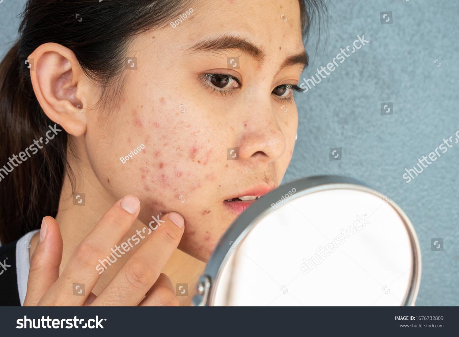 Portrait of Asian woman worry about her face when she saw the problem of acne inflammation and scar by the mini mirror. Conceptual shot of Acne  Problem Skin on female face. #1676732809