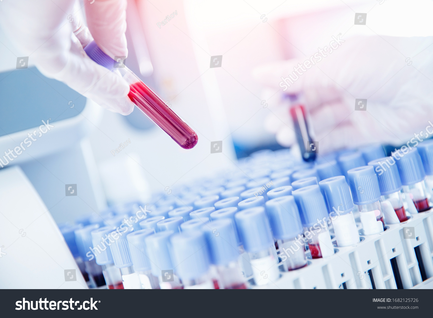 Lab worker preparing test blood for detection of antibodies and infections Corona virus. #1682125726