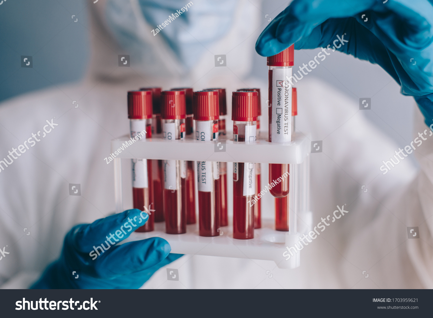 Coronavirus testing. The doctor holds in his hand a test tube with a blood sample with a positive result. Super close-up. #1703959621